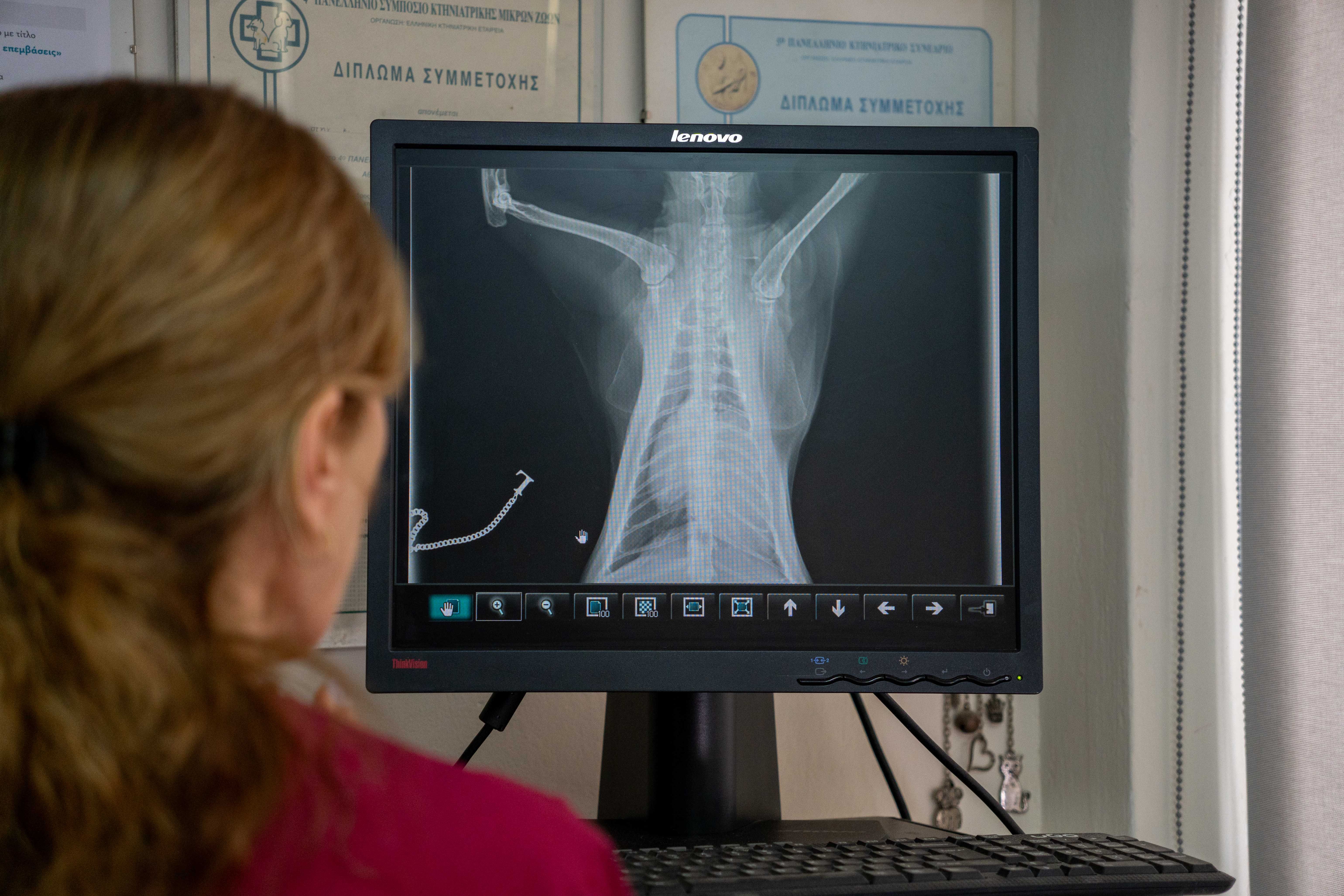 Εικόνα για ψηφιακές ακτινογραφίες